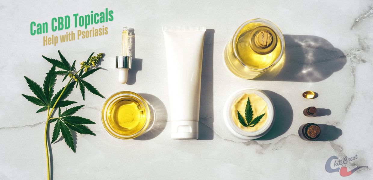 Can CBD Topicals Help with Psoriasis