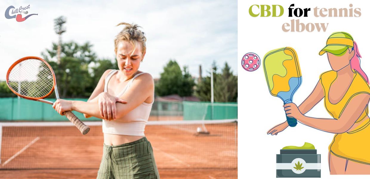CBD for tennis elbow